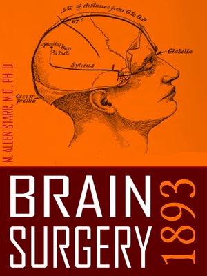 cover image of Brain Surgery
